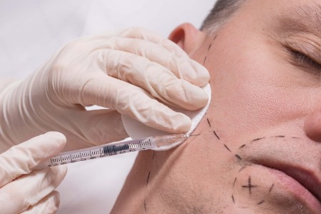 Facial Hair Transplant: A Permanent Solution To Filling The Hair Less Gaps